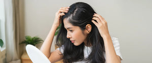 Winter Hair Care: Prevent Hair Fall in Cold Months