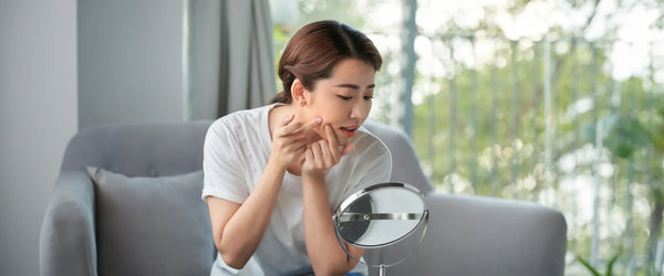 Effective Home Remedies to Remove Blackheads Naturally