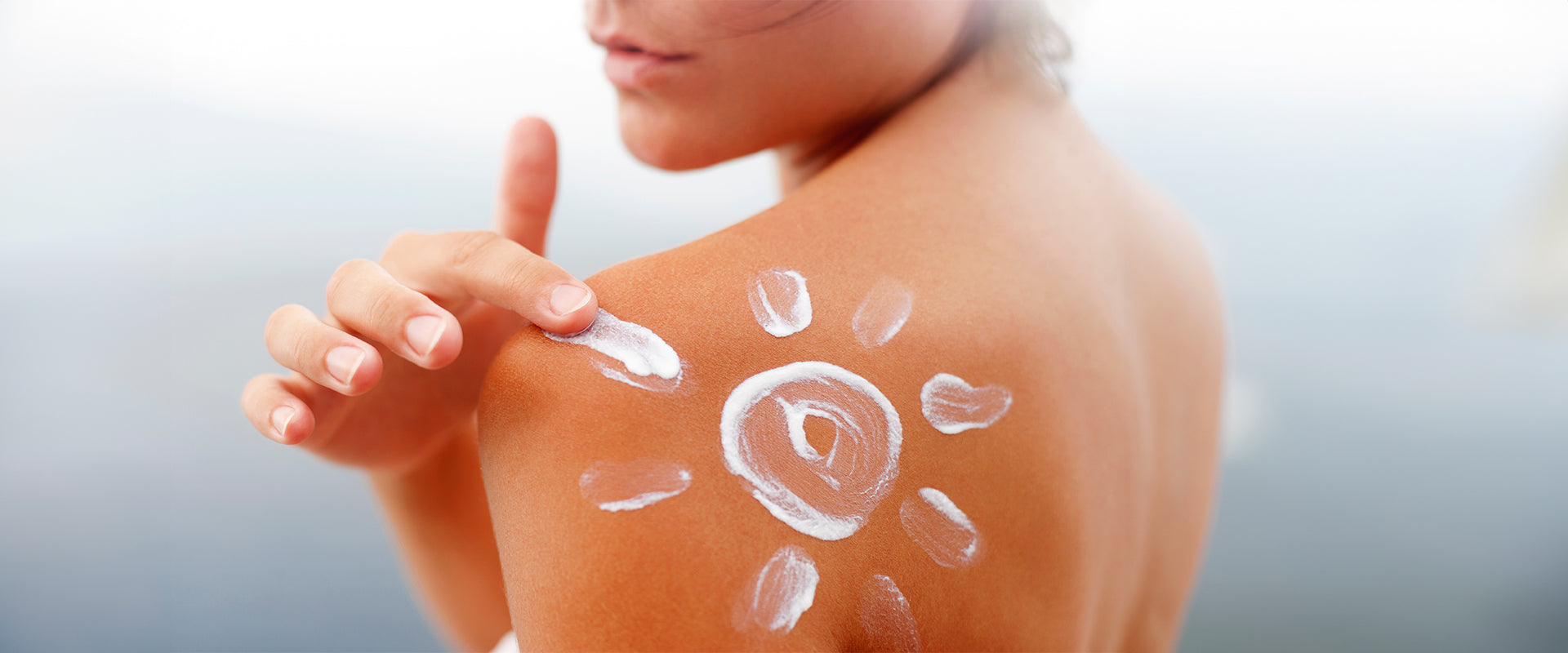 Top 10 Home Remedies to Treat Sunburn